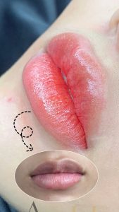 có mấy bước tiến hành phun xăm