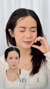 khử thâm môi có đau không