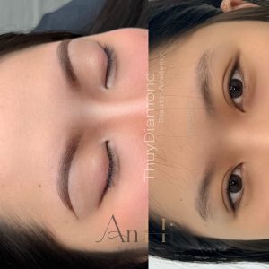 khử thâm môi có lên màu không