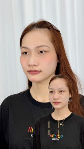 khử thâm môi giá