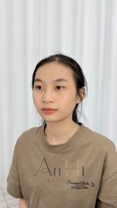 phun xăm nốt ruồi phong thủy