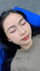 sau phun xăm uống thuốc gì