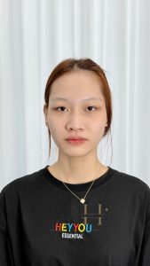 công nghệ khử thâm môi Quận 9 - Thủ Đức