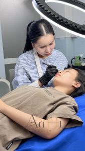 hình ảnh khử thâm môi Quận 9 - Thủ Đức