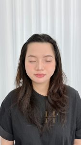 khử thâm môi ăn gì tốt Quận 9 - Thủ Đức