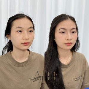 khử thâm môi ăn trứng được không Quận 9 - Thủ Đức