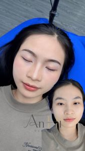 khử thâm môi bao lâu 1 lần Quận 9 - Thủ Đức