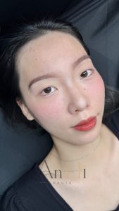 khử thâm môi đại học y dược Quận 9 - Thủ Đức