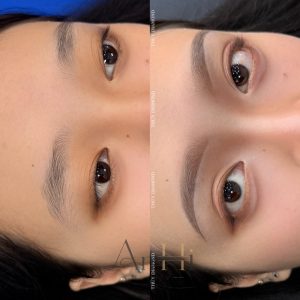 khử thâm môi diva Quận 9 - Thủ Đức