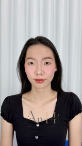 khử thâm môi được ăn trứng không Quận 9 - Thủ Đức