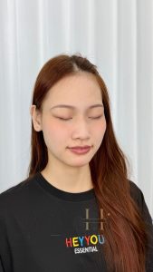 khử thâm môi duy trì được bao lâu Quận 9 - Thủ Đức
