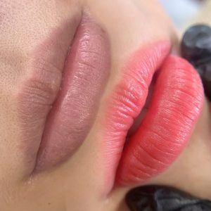 khử thâm môi khoảng bao lâu Quận 9 - Thủ Đức