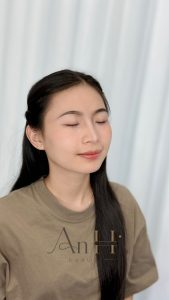 khử thâm môi kiêng trứng bao lâu Quận 9 - Thủ Đức