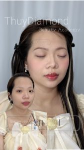 khử thâm môi ngọc dung Quận 9 - Thủ Đức