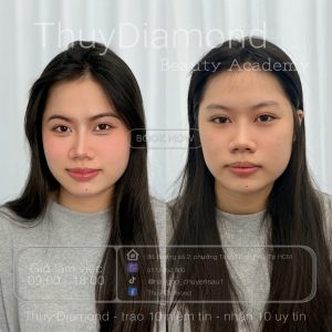 khử thâm môi như thế nào Quận 9 - Thủ Đức