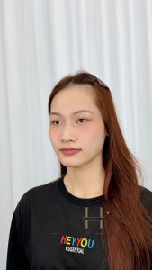 khử thâm môi quận 7 Quận 9 - Thủ Đức