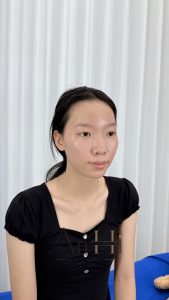 khử thâm môi review Quận 9 - Thủ Đức