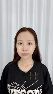 khử thâm môi sau bao lâu thì lên màu Quận 9 - Thủ Đức