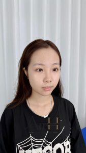 khử thâm môi sẽ như thế nào Quận 9 - Thủ Đức