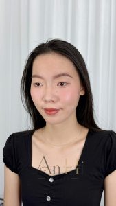 khử thâm môi sưng bao lâu Quận 9 - Thủ Đức