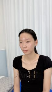 khử thâm môi uống rau má được không Quận 9 - Thủ Đức