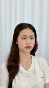 khử thâm môi xong có kiêng gì không Quận 9 - Thủ Đức
