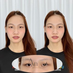 mới khử thâm môi ăn trứng được không Quận 9 - Thủ Đức