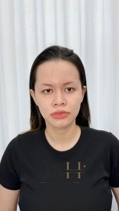 mới khử thâm môi nên ăn gì Quận 9 - Thủ Đức