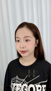 môi khử thâm nam Quận 9 - Thủ Đức