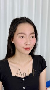phun môi rồi có khử thâm được không Quận 9 - Thủ Đức