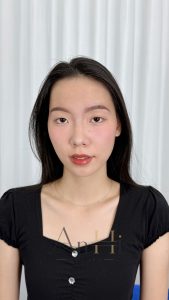 review khử thâm môi cho nam Quận 9 - Thủ Đức