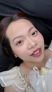 tinh chất khử thâm môi Quận 9 - Thủ Đức